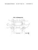 MODULARIZED STRUCTURE OF REAR SUSPENSION diagram and image