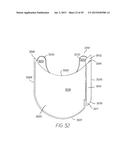 CONVEYOR BELT FOR PRODUCT STABILIZATION diagram and image