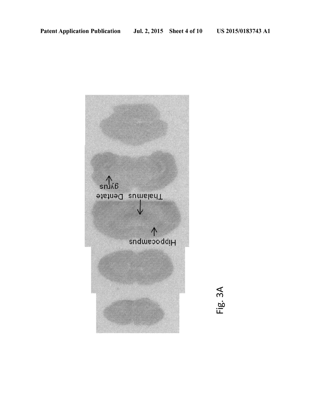 COMPOUND AND USE OF COMPOUND TO PREPARE A RADIOLABELLED COMPOUND - diagram, schematic, and image 05