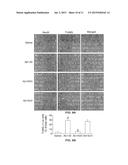 Antisense Oligonucleotides Against Neutral Sphingomyelinase and Neutral     Sphingomyelinase Inhibitor GW4869 for Degenerative Neurological Disorders diagram and image