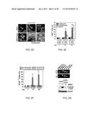 GENE EXPRESSION PROFILES ASSOCIATED WITH METASTATIC BREAST CANCER diagram and image