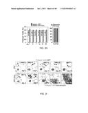 GENE EXPRESSION PROFILES ASSOCIATED WITH METASTATIC BREAST CANCER diagram and image