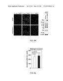 GENE EXPRESSION PROFILES ASSOCIATED WITH METASTATIC BREAST CANCER diagram and image