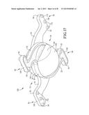 TIE SYSTEM FOR INSULATED CONCRETE PANELS diagram and image