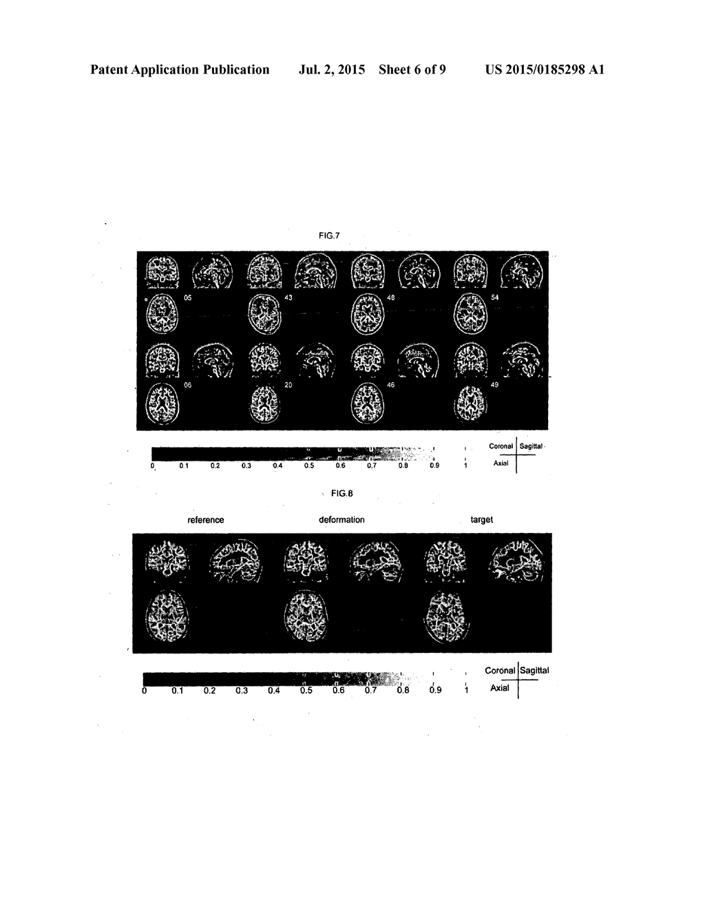 METHOD OF ESTIMATING SPECIFIC ABSORPTION RATE - diagram, schematic, and image 07