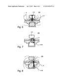 PROCESSING OF BOUND AND UNBOUND MAGNETIC PARTICLES diagram and image