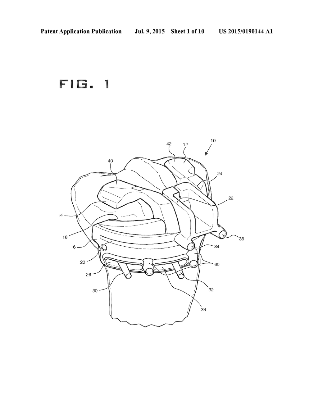 INTRA-OPERATIVELY ADJUSTABLE CUTTING GUIDE - diagram, schematic, and image 02