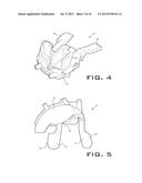 INTRA-OPERATIVELY ADJUSTABLE CUTTING GUIDE diagram and image