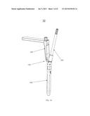 INSTRUMENTS AND METHODS FOR SHAPING A BONE CAVITY diagram and image