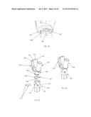 INSTRUMENTS AND METHODS FOR SHAPING A BONE CAVITY diagram and image