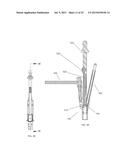 INSTRUMENTS AND METHODS FOR SHAPING A BONE CAVITY diagram and image