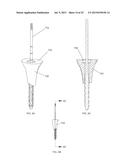 INSTRUMENTS AND METHODS FOR SHAPING A BONE CAVITY diagram and image