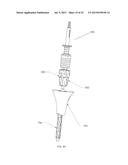 INSTRUMENTS AND METHODS FOR SHAPING A BONE CAVITY diagram and image