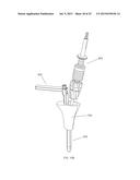 INSTRUMENTS AND METHODS FOR SHAPING A BONE CAVITY diagram and image