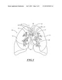 NON-INVASIVE AND MINIMALLY INVASIVE DENERVATION METHODS AND SYSTEMS FOR     PERFORMING THE SAME diagram and image