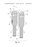 STENT GRAFT DELIVERY SYSTEMS AND ASSOCIATED METHODS diagram and image