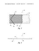 STENT GRAFT DELIVERY SYSTEMS AND ASSOCIATED METHODS diagram and image