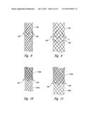 STENT GRAFT DELIVERY SYSTEMS AND ASSOCIATED METHODS diagram and image