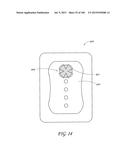 WOUND DRESSING AND METHOD OF TREATMENT diagram and image