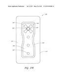 WOUND DRESSING AND METHOD OF TREATMENT diagram and image