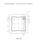 WOUND DRESSING AND METHOD OF TREATMENT diagram and image