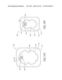 WOUND DRESSING AND METHOD OF TREATMENT diagram and image