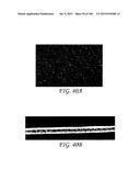 WOUND DRESSING AND METHOD OF TREATMENT diagram and image