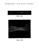 WOUND DRESSING AND METHOD OF TREATMENT diagram and image