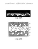 WOUND DRESSING AND METHOD OF TREATMENT diagram and image