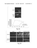 ACTIVATION OF HISTONE DEACETYLASE 1 (HDAC1) PROTECTS AGAINST DNA DAMAGE     AND INCREASES NEURONAL SURVIVAL diagram and image