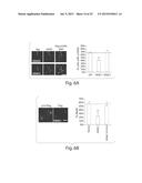 ACTIVATION OF HISTONE DEACETYLASE 1 (HDAC1) PROTECTS AGAINST DNA DAMAGE     AND INCREASES NEURONAL SURVIVAL diagram and image