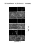 Method Of Reducing Injury To Mammalian Cells diagram and image