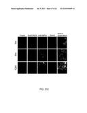 Method Of Reducing Injury To Mammalian Cells diagram and image