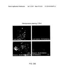 Method Of Reducing Injury To Mammalian Cells diagram and image