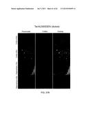 Method Of Reducing Injury To Mammalian Cells diagram and image