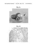 THERAPEUTIC TRANSPLANTATION USING DEVELOPING, HUMAN OR PORCINE, RENAL OR     HEPATIC, GRAFTS diagram and image