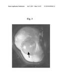 THERAPEUTIC TRANSPLANTATION USING DEVELOPING, HUMAN OR PORCINE, RENAL OR     HEPATIC, GRAFTS diagram and image