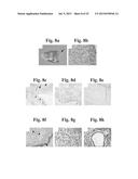 THERAPEUTIC TRANSPLANTATION USING DEVELOPING, HUMAN OR PORCINE, RENAL OR     HEPATIC, GRAFTS diagram and image