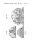 THERAPEUTIC TRANSPLANTATION USING DEVELOPING, HUMAN OR PORCINE, RENAL OR     HEPATIC, GRAFTS diagram and image