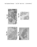 THERAPEUTIC TRANSPLANTATION USING DEVELOPING, HUMAN OR PORCINE, RENAL OR     HEPATIC, GRAFTS diagram and image