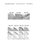 THERAPEUTIC TRANSPLANTATION USING DEVELOPING, HUMAN OR PORCINE, RENAL OR     HEPATIC, GRAFTS diagram and image