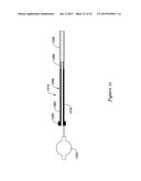 GUIDE EXTENSION CATHETER diagram and image