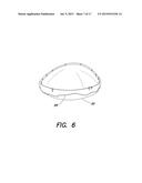 CONTAINMENT SYSTEM AND INCREASED STRENGTH RADOME ASSEMBLY diagram and image