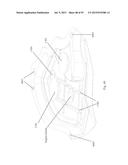 CONE GRIP FOR HANDGUN diagram and image