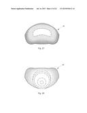 BOTTLE SLEEVE AND MATING BOTTLE diagram and image