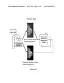 CONVERTING LOW-DOSE TO HIGHER DOSE MAMMOGRAPHIC IMAGES THROUGH     MACHINE-LEARNING PROCESSES diagram and image