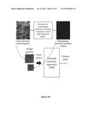 CONVERTING LOW-DOSE TO HIGHER DOSE MAMMOGRAPHIC IMAGES THROUGH     MACHINE-LEARNING PROCESSES diagram and image