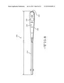 RETRACTOR TOOLS FOR MINIMALLY INVASIVE HIP SURGERY diagram and image