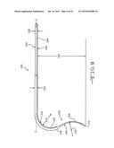 RETRACTOR TOOLS FOR MINIMALLY INVASIVE HIP SURGERY diagram and image