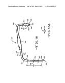 RETRACTOR TOOLS FOR MINIMALLY INVASIVE HIP SURGERY diagram and image